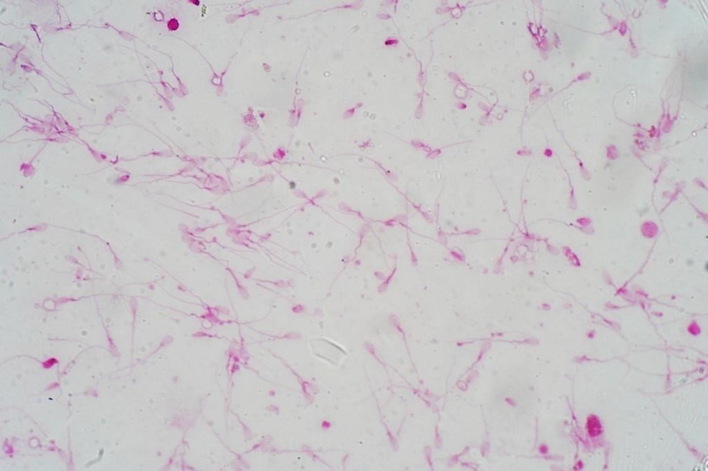 CASA, czyli podglądanie mikrokosmosu męskiej płodności